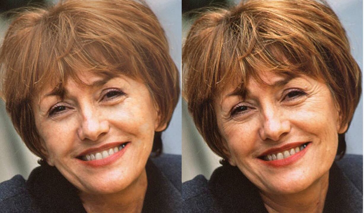 fotos de la cara antes y después del contorno